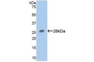 Detection of Recombinant STAT3, Human using Polyclonal Antibody to Signal Transducer And Activator Of Transcription 3 (STAT3)