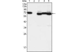 Western blot analysis using TCF3 mouse mAb against A549 (1), A431 (2), Hela (3), PANC-1 (4) and PC-3 (5) cell lysate. (TCF3 antibody)