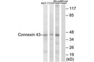 Western blot analysis of extracts from MCF-7/COS7/Mouse Heart, using Connexin 43 (Ab-367) Antibody. (Connexin 43/GJA1 antibody  (AA 332-381))