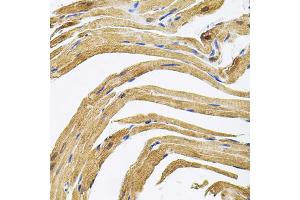 Immunohistochemistry of paraffin-embedded rat heart using CEP164 antibody. (CEP164 antibody)