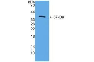 Detection of Recombinant TFF3, Mouse using Polyclonal Antibody to Trefoil Factor 3 (TFF3) (TFF3 antibody  (AA 23-81))