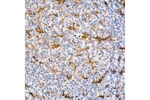 Immunohistochemistry of paraffin-embedded Human tonsil (positive control antibody staining, clone 55k-2) using Fascin/FSCN1 antibody (ABIN7267142) at dilution of 1:100 (40x lens). (Fascin antibody)