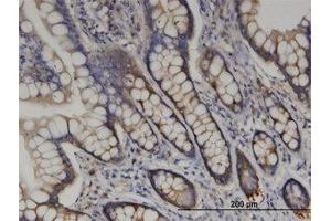 Image no. 2 for anti-Arginyl-tRNA Synthetase (RARS) (AA 1-661) antibody (ABIN599427) (RARS antibody  (AA 1-661))