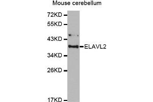 Western Blotting (WB) image for anti-ELAV (Embryonic Lethal, Abnormal Vision, Drosophila)-Like 2 (Hu Antigen B) (ELAVL2) antibody (ABIN1876947) (ELAVL2 antibody)