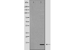 Western blot analysis of Hela whole cell lysates, using RBX1 Antibody. (RBX1 antibody  (C-Term))