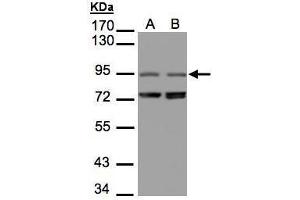 WB Image Sample(30 μg of whole cell lysate) A:293T B:Raji, 7. (NIR1 antibody  (C-Term))