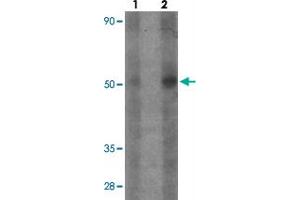 Western blot analysis of ATG14 in human small Intestine tissue with ATG14 polyclonal antibody  at (1) 1 and (2) 2 ug/mL. (ATG14 antibody  (Internal Region))