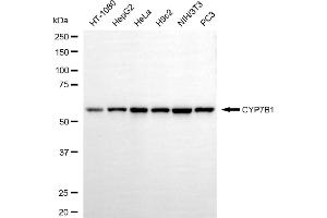 anti-Cytochrome P450, Family 7, Subfamily B, Polypeptide 1 (CYP7B1) antibody