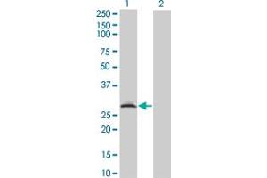 Western Blot analysis of RAD1 expression in transfected 293T cell line by RAD1 monoclonal antibody (M01A), clone 1G2. (RAD1 antibody  (AA 1-90))