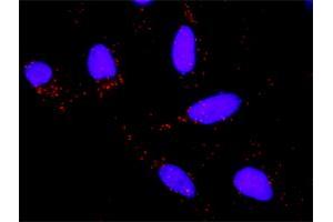 Proximity Ligation Analysis of protein-protein interactions between TP53 and HSPA1B. (HSPA1B antibody  (AA 531-611))