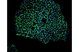 Immunoflourescent staining of Nanog in human embryonic stem cells. (Nanog antibody)