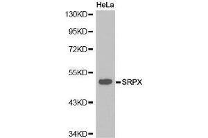 Western Blotting (WB) image for anti-Sushi-Repeat Containing Protein, X-Linked (SRPX) (AA 40-320) antibody (ABIN6215763) (SRPX antibody  (AA 40-320))