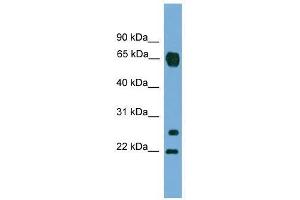 MMP26 antibody used at 0. (MMP26 antibody  (C-Term))