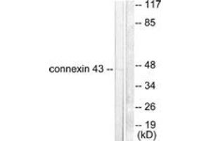 Western blot analysis of extracts from A549 cells, using Connexin 43 Antibody. (Connexin 43/GJA1 antibody  (AA 333-382))