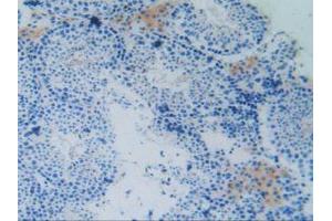 IHC-P analysis of Mouse Testis Tissue, with DAB staining. (MAPT antibody  (AA 92-400))