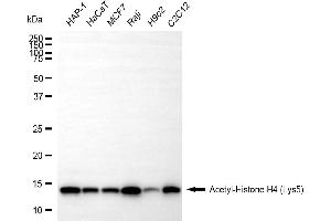 Western blotting analysis using acetyl-Histone H4 (Lys5) antibody (ABIN7798980).