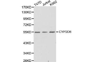Western Blotting (WB) image for anti-Cytochrome P450, Family 2, Subfamily D, Polypeptide 6 (CYP2D6) (AA 20-230) antibody (ABIN6216807)