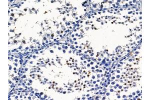 ABIN6259773 and ABIN6279079 at 1/100 staining mouse testis tissue by IHC-P.