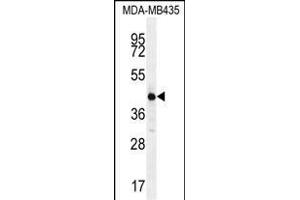 ALX4 Antibody (Center) (ABIN654344 and ABIN2844113) western blot analysis in MDA-M cell line lysates (35 μg/lane). (ALX4 antibody  (AA 249-275))