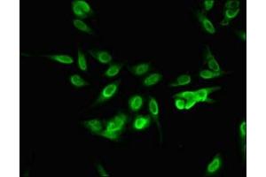 Immunofluorescent analysis of Hela cells using ABIN7168329 at dilution of 1:100 and Alexa Fluor 488-congugated AffiniPure Goat Anti-Rabbit IgG(H+L) (RNA Binding Motif Protein, Y Chromosome (RBMY) (AA 501-700) antibody)