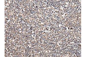 The image on the left is immunohistochemistry of paraffin-embedded Human tonsil tissue using ABIN7128064(UGGT2 Antibody) at dilution 1/20, on the right is treated with fusion protein. (UGCGL2 antibody)