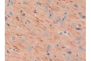 #VALUE! (MEPE antibody  (AA 28-224))