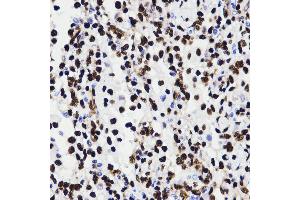 Immunohistochemistry (IHC) image for anti-High Mobility Group Box 1 (HMGB1) (AA 100-200) antibody (ABIN3023358) (HMGB1 antibody  (AA 100-200))
