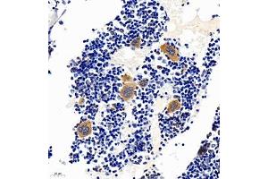 Immunohistochemistry of paraffin embedded mouse bone using TREML1 (ABIN7076009) at dilution of 1:2200 (400x lens) (TREML1 antibody)
