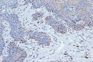 Immunohistochemistry of paraffin-embedded human esophageal using STK3/MST2 Rabbit mAb (ABIN7270223) at dilution of 1:100 (40x lens). (STK3 antibody)