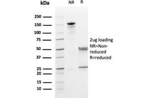 SDS-PAGE Analysis Purified CD5 Mouse Monoclonal Antibody (CD5/2419). (CD5 antibody  (AA 269-366))