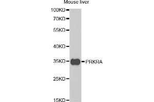 Western blot analysis of extracts of mouse liver, using PRKRA antibody (ABIN5973144) at 1/1000 dilution. (PRKRA antibody)