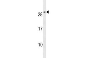 CFC1B antibody western blot analysis in NCI-H292 lysate (CFC1B antibody  (AA 20-48))