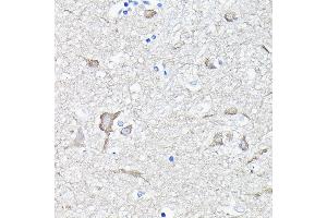 Immunohistochemistry of paraffin-embedded human brain using EEF1 Rabbit pAb (ABIN6129010, ABIN6139947, ABIN6139948 and ABIN6223167) at dilution of 1:100 (40x lens). (EEF1A2 antibody  (AA 184-463))