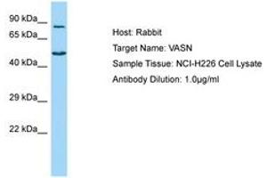 Image no. 1 for anti-Vasorin (Vasn) (AA 521-570) antibody (ABIN6750146) (Vasn antibody  (AA 521-570))
