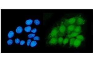 IF analysis of DHPS/DHS using anti-DHPS/DHS antibody (ABIN7601998).