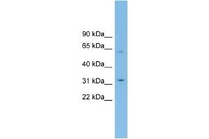 WB Suggested Anti-SLC39A9 Antibody Titration: 0. (SLC39A9 antibody  (Middle Region))
