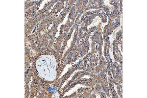 IHC analysis of SFXN3 using anti-SFXN3 antibody (ABIN7601302). (SFXN3 antibody  (AA 32-321))