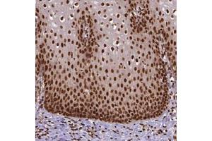 Immunohistochemical staining (Formalin-fixed paraffin-embedded sections) of human esophagus with NACC1 polyclonal antibody  shows nuclear positivity in squamous epithelial cells.