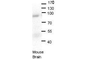 LSS antibody - N-terminal region  validated by WB using Mouse brains at 1:1000.