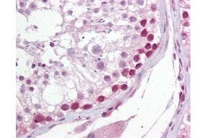 Anti-UNG antibody IHC of human testis. (UNG antibody  (AA 281-298))