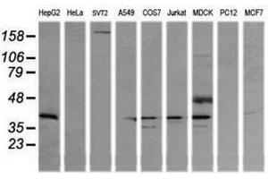 Image no. 4 for anti-Mitogen-Activated Protein Kinase Kinase 3 (MAP2K3) antibody (ABIN1499403)