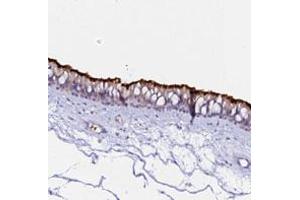 Immunohistochemical staining of human nasopharynx with CCDC19 polyclonal antibody  shows strong positivity in cilia of respiratory epithelial cells at 1:200-1:500 dilution. (CCDC19 antibody)