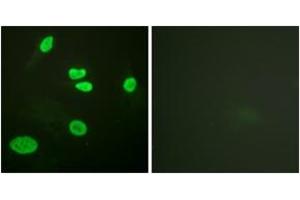 Immunofluorescence analysis of HeLa cells, using Histone H3 (Acetyl-Lys9) Antibody. (Histone 3 antibody  (H3K9ac))