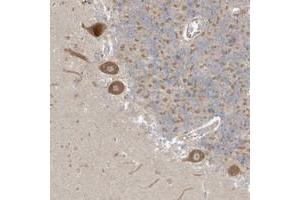 Immunohistochemical staining of human cerebellum with NPPC polyclonal antibody  shows moderate cytoplasmic positivity in purkinje cells.