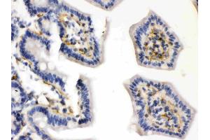 Caldesmon was detected in paraffin-embedded sections of mouse intestine tissues using rabbit anti- Caldesmon Antigen Affinity purified polyclonal antibody (Catalog # ) at 1 µg/mL. (Caldesmon antibody  (AA 1-120))