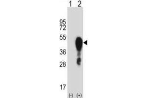 Western Blotting (WB) image for anti-Homeobox A1 (HOXA1) antibody (ABIN2998004) (HOXA1 antibody)