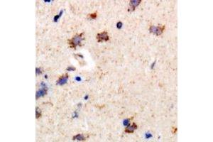 Immunohistochemical analysis of PIP4K2 beta staining in rat brain formalin fixed paraffin embedded tissue section.