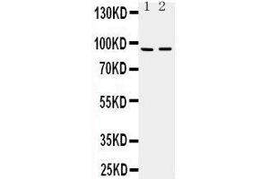 Western Blotting (WB) image for anti-ADAM Metallopeptidase with Thrombospondin Type 1 Motif, 4 (ADAMTS4) (AA 820-837), (C-Term) antibody (ABIN3043192)