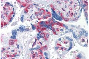 Human Placenta: Formalin-Fixed, Paraffin-Embedded (FFPE) (G3BP1 antibody  (AA 214-303))