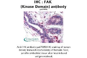 Image no. 1 for anti-PTK2 Protein tyrosine Kinase 2 (PTK2) antibody (ABIN1734244)